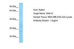 Rad51D Rabbit anti-Human, Polyclonal, Novus Biologicals 0.1 mL | Buy Online | Novus Biologicals | Fisher Scientific